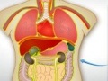 Transplant organesh 2 për të luajtur online